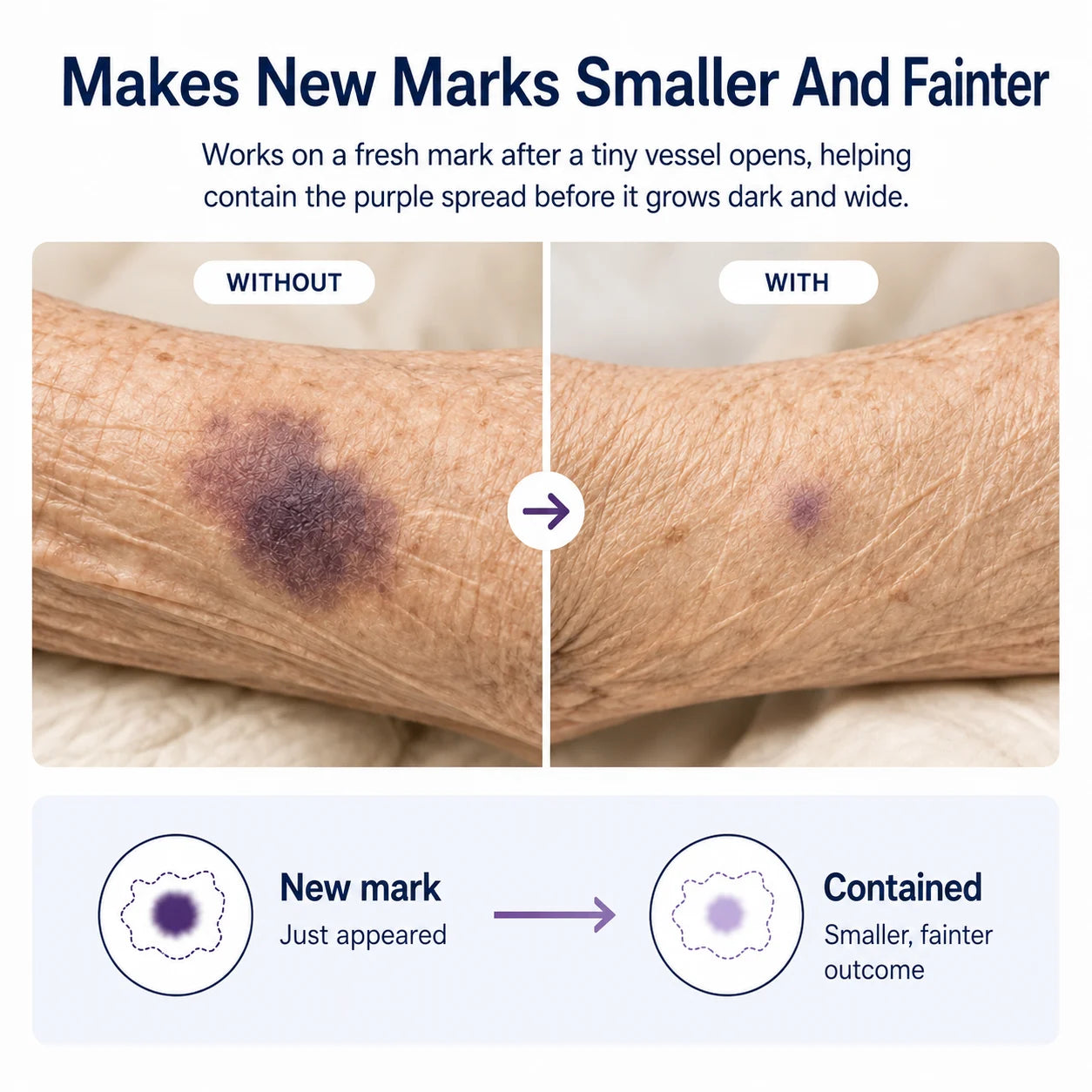Vitamin K on a new mark: smaller and fainter than the same mark without it