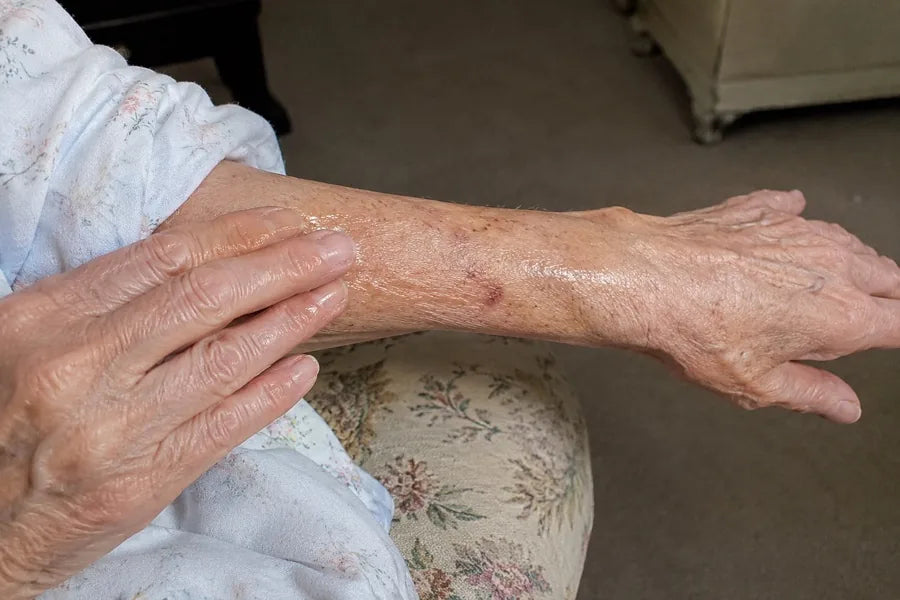 Step 2 — worked over the whole forearm