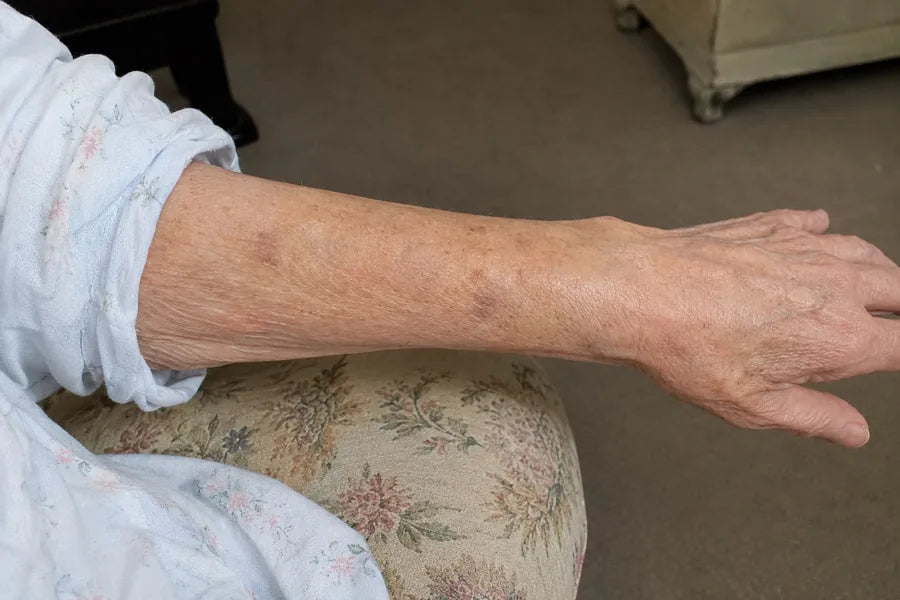 A forearm beside the Fadewell tube in daylight