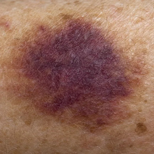 Close crop of a mark going from purple to brown