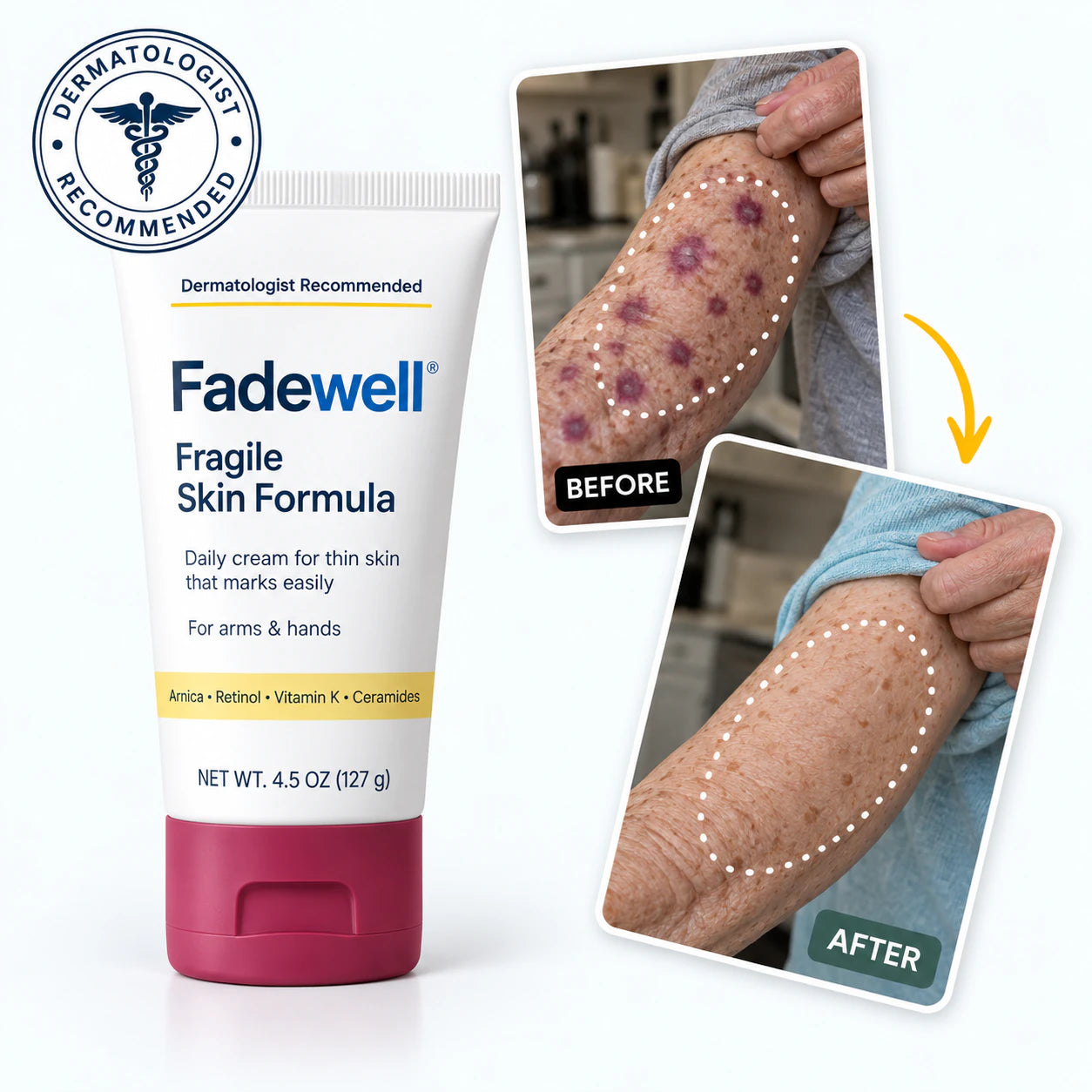 Fadewell Fragile Skin Formula with before-and-after forearm imagery